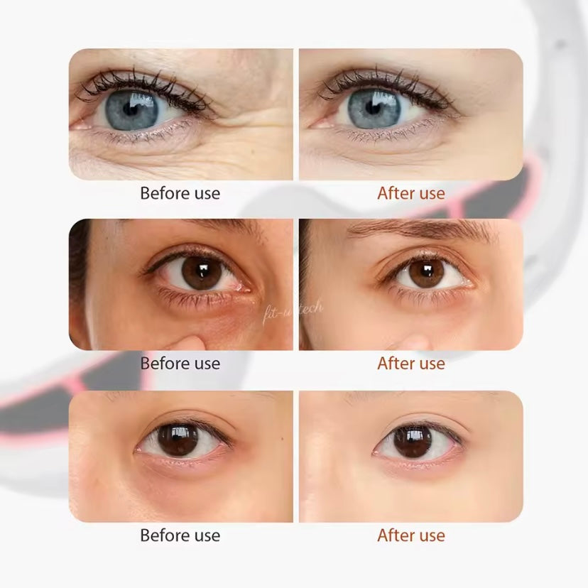 VisionEase™ 3D Oogmassage‑Bril